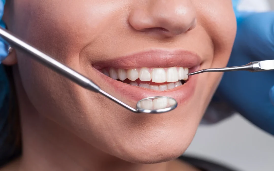 All on four implant