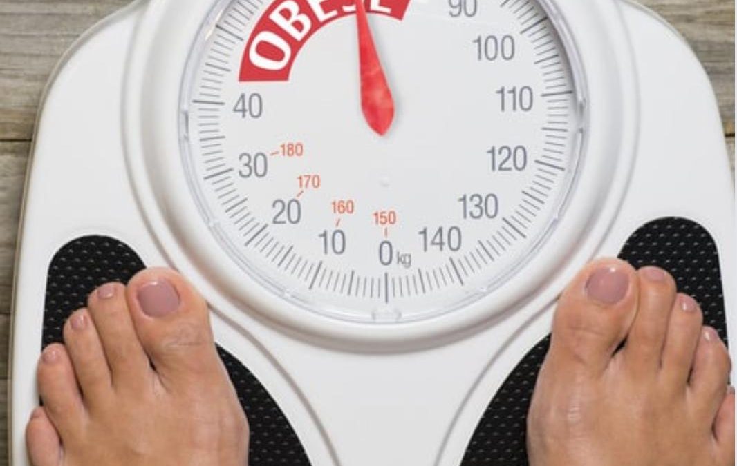 Mini Gastrik Bypass