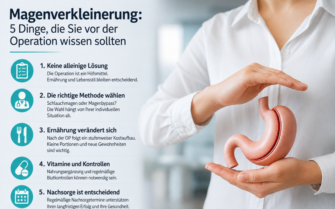 Magenverkleinerung: 5 Dinge, die Sie vor der OP wissen sollten